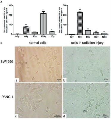 Exogenous HMGB1 Promotes the Proliferation and Metastasis of <mark class="highlighted">Pancreatic Cancer Cells</mark>